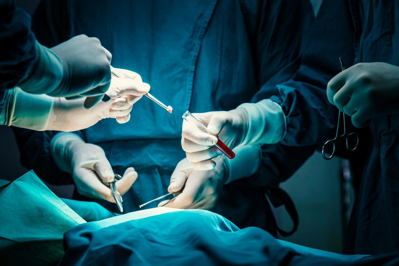 biopsy