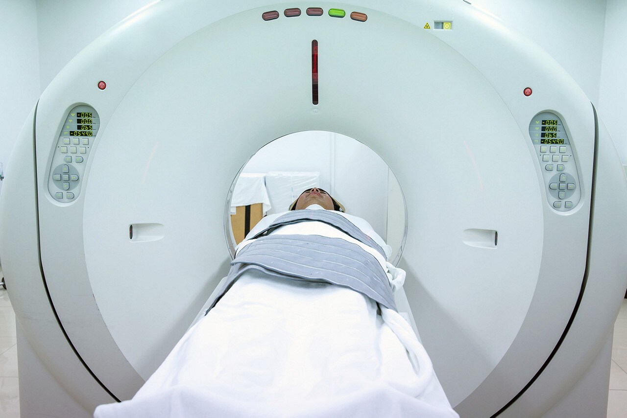 ct scan