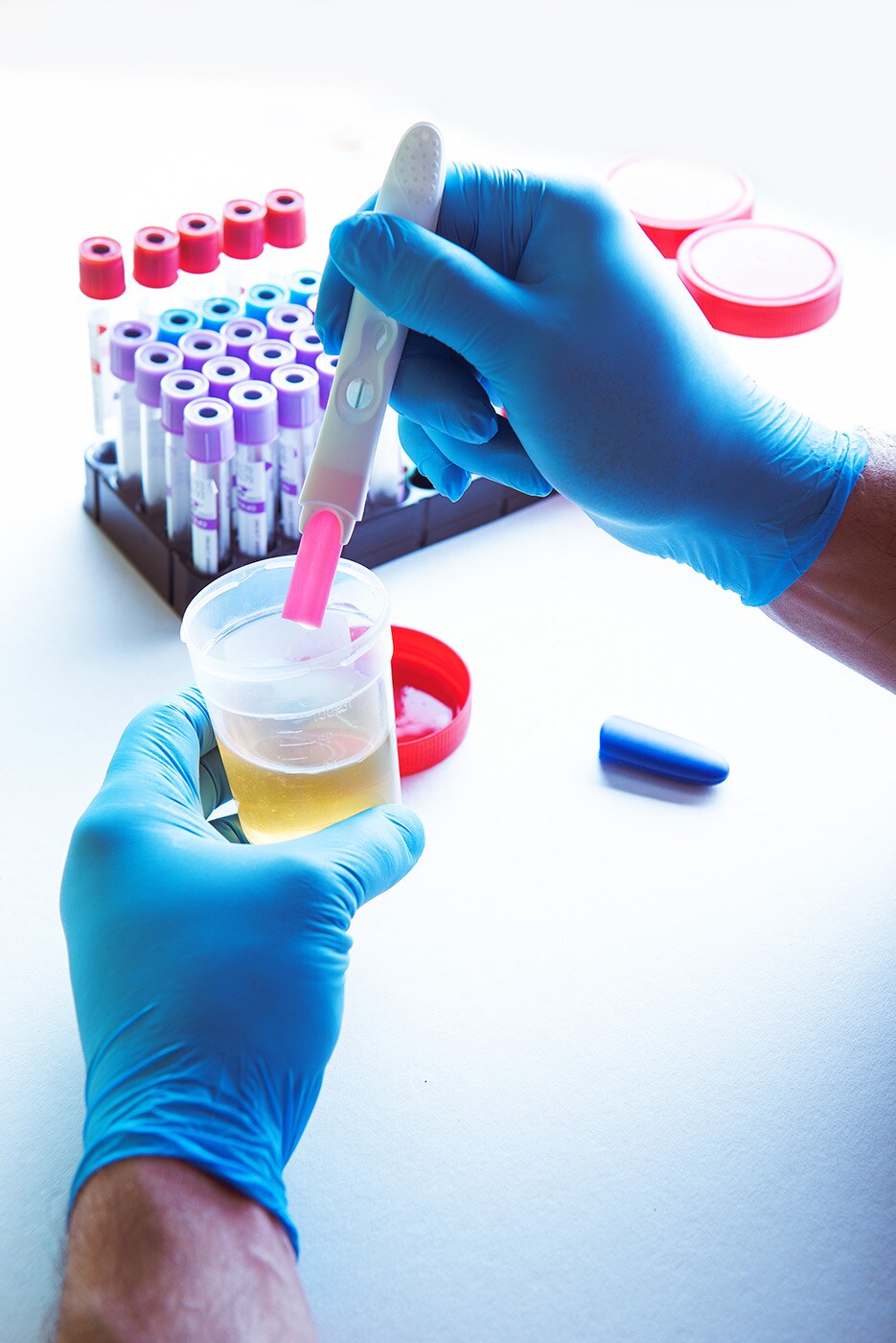 bladder cancer urine test